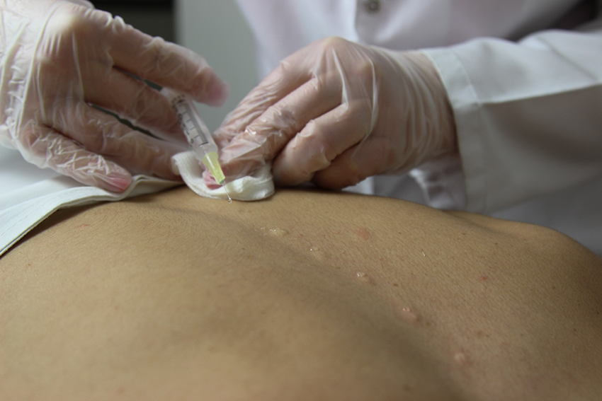 Nöral Terapi Hangi Hastalıkların Tedavisinde Kullanılır?